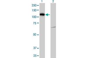 Western Blot analysis of LLGL2 expression in transfected 293T cell line by LLGL2 monoclonal antibody (M06), clone 4G2. (LLGL2 anticorps  (AA 101-199))