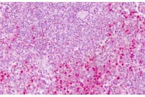 Anti-PTPRE antibody IHC staining of human spleen. (PTPRE anticorps  (Cytoplasmic Domain))