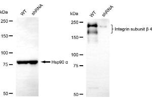 Western blotting analysis using integrin subunit beta 4 antibody (ABIN7799073).