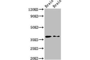 Western Blot Positive WB detected in: Rat brain tissue, Mouse brain tissue All lanes: PEX10 antibody at 2. (PEX1 anticorps  (AA 63-157))