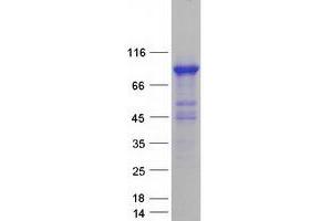 Validation with Western Blot