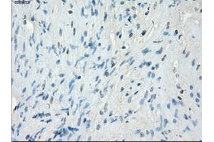 Immunohistochemical staining of paraffin-embedded Ovary tissue using anti-PRKAR1Amouse monoclonal antibody. (PRKAR1A anticorps)