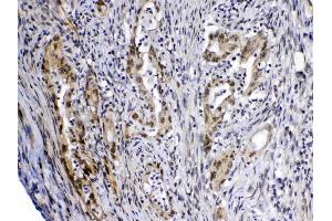 IHC analysis of MED4 using anti-MED4 antibody .
