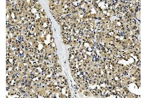 IHC analysis of CSNK2B using anti-CSNK2B antibody (ABIN7599092). (CSNK2B anticorps  (AA 1-215))