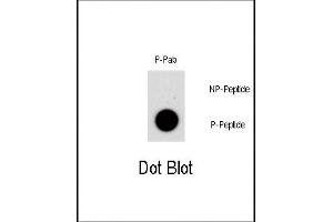Dot blot analysis of Phospho-NR4A1- polyclonal antibody (ABIN389736 and ABIN2839675) on nitrocellulose membrane.