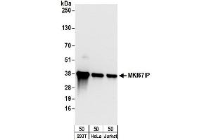 anti-MKI67 FHA Domain-Interacting Nucleolar Phosphoprotein (MKI67IP) (AA 243-293) antibody