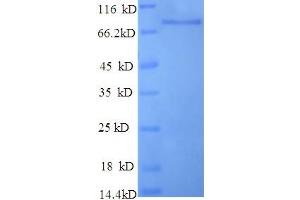 SDS-PAGE (SDS) image for Breast Carcinoma Amplified Sequence 1 (BCAS1) (AA 1-584), (full length) protein (His tag) (ABIN5713274)