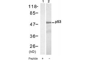 Image no. 1 for anti-Tumor Protein P53 (TP53) (Ser9) antibody (ABIN319302) (p53 anticorps  (Ser9))