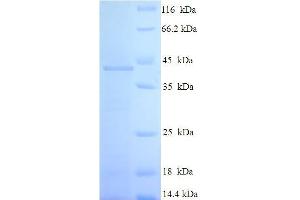 SDS-PAGE (SDS) image for RAB3C, Member RAS Oncogene Family (Rab3c) (AA 1-227), (full length) protein (His-SUMO Tag) (ABIN5711640)