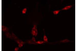 ABIN6275761 staining HeLa by IF/ICC. (CYP11A1 anticorps  (C-Term))
