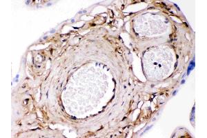 Galectin 1 was detected in paraffin-embedded sections of human placenta tissues using rabbit anti- Galectin 1 Antigen Affinity purified polyclonal antibody (Catalog # ) at 1 µg/mL.