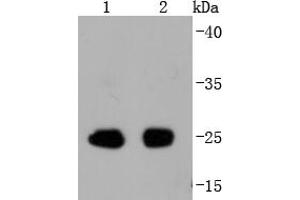 Lane 1: Mouse spleen, Lane 2: Rat spleen cell lysate probed with eIF4E(S209) (2B1) Monoclonal Antibody  at 1:1000 overnight at 4˚C. (EIF4E anticorps  (pSer209))