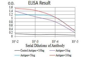 Black line: Control Antigen (100 ng),Purple line: Antigen (10 ng), Blue line: Antigen (50 ng), Red line:Antigen (100 ng)