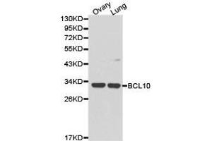 Western Blotting (WB) image for anti-B-Cell CLL/lymphoma 10 (BCL10) antibody (ABIN1871246) (BCL10 anticorps)