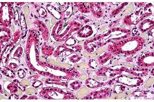 Human Kidney, Tubules: Formalin-Fixed, Paraffin-Embedded (FFPE)