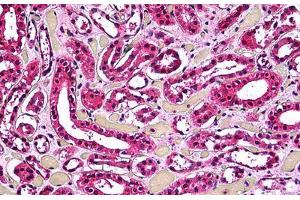 Human Kidney, Tubules: Formalin-Fixed, Paraffin-Embedded (FFPE) (ACP2 anticorps  (AA 1-424))