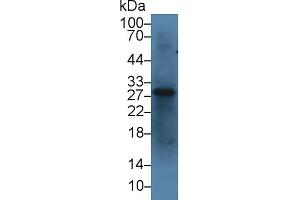 Detection of IGFBP1 in Bovine Liver lysate using Polyclonal Antibody to Insulin Like Growth Factor Binding Protein 1 (IGFBP1) (IGFBPI anticorps  (AA 112-263))