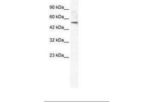 Image no. 2 for anti-Sphingomyelin phosphodiesterase, Acid-Like 3B (SMPDL3B) (AA 88-137) antibody (ABIN6735957) (SMPDL3B anticorps  (AA 88-137))