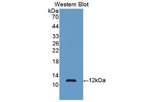 Western blot analysis of the recombinant protein. (Renin anticorps  (AA 144-237))