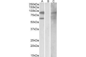 HEK293 lysate (10ug protein in RIPA buffer) overexpressing Human RACGAP1 with DYKDDDDK tag probed with ABIN2564849 (0.