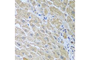 Immunohistochemistry of paraffin-embedded human liver using WDR48 antibody (ABIN5974731) at dilution of 1/100 (40x lens). (WDR48 anticorps)