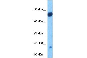 Host:  Rabbit  Target Name:  NDUFB11  Sample Tissue:  Human Lung Tumor lysates  Antibody Dilution:  1ug/ml