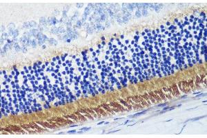 Immunohistochemistry of paraffin-embedded Rat retina using PDE6B Polyclonal Antibody at dilution of 1:200 (40x lens). (PDE6B anticorps)