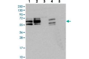 Western blot analysis of Lane 1: RT-4, Lane 2: U-251 MG, Lane 3: Human Plasma, Lane 4: Liver, Lane 5: Tonsil with BICC1 polyclonal antibody  at 1:250-1:500 dilution. (BICC1 anticorps)