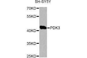 Western blot analysis of extracts of SH-SY5Y cells, using PDK3 Antibody. (PDK3 anticorps)