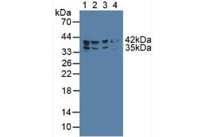 Western blot analysis of (1) Human HepG2 Cells, (2) Porcine Liver Tissue, (3) Porcine Large IntestineTissue and (4) Rat Pancreas Tissue. (FADS2 anticorps  (AA 1-130))