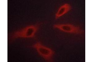 ABIN6267254 staining K562 cells by ICC/IF. (ABL1 anticorps  (pTyr245))