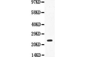 Anti-IL18 Picoband antibody,  All lanes: Anti-IL18 at 0. (IL-18 anticorps  (AA 37-193))