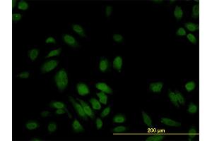 Immunofluorescence of monoclonal antibody to S100A6 on HeLa cell. (S100A6 anticorps  (AA 1-90))