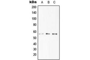 Western blot analysis of DR4 expression in HeLa (A), Jurkat (B), RAW264. (DR4 anticorps  (C-Term))