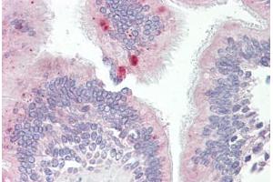 Anti-AP3M1 antibody IHC staining of human lung, respiratory epithelium. (AP3M1 anticorps  (AA 140-190))