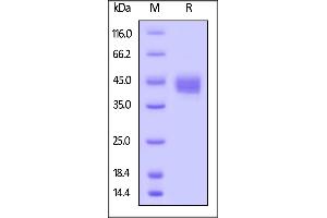 Biotinylated Human CD23, His,Avitag on  under reducing (R) condition.