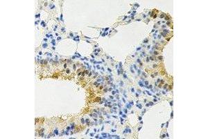 Immunohistochemical analysis of PPX staining in rat lung formalin fixed paraffin embedded tissue section.