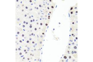 Immunohistochemistry of paraffin-embedded rat liver using RUNX1 antibody (ABIN6291786) at dilution of 1:100 (40x lens). (RUNX1 anticorps)