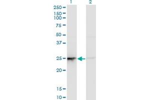 Western Blot analysis of PSMD10 expression in transfected 293T cell line by PSMD10 monoclonal antibody (M19), clone 3F10.