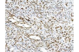 IHC analysis of Emerin using anti-Emerin antibody (ABIN4886569). (Emerin anticorps  (N-Term))