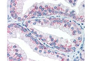 Anti-AKT1S1 / PRAS40 antibody IHC of human prostate. (PRAS40 anticorps)