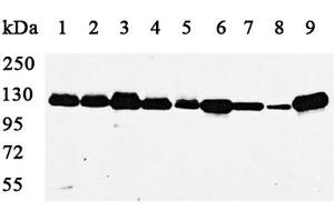Western blot analysis using PARP1 antibody against MCF(1), A549(2), HepG2(3), COS7(4),C2C12(5),A431(6),MDCK(7),PC12(8) and Jurkat cell lysate(9).