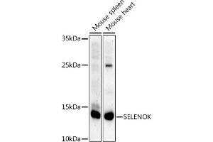 Western blot analysis of extracts of various cell lines, using SELENOK antibody (ABIN7270194) at 1:1000 dilution. (Selenoprotein K (SELENOK) anticorps)