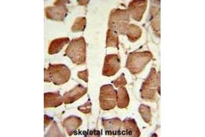 Immunohistochemistry (IHC) image for anti-Aspartoacylase (ASPA) antibody (ABIN3002840)