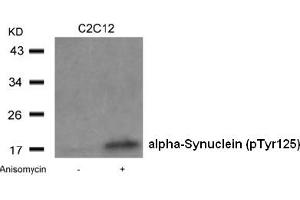 Image no. 2 for anti-Synuclein, alpha (SNCA) (pTyr125) antibody (ABIN401546) (SNCA anticorps  (pTyr125))
