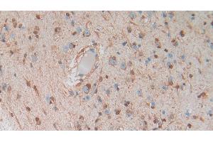 Detection of S100B in Human Cerebrum Tissue using Polyclonal Antibody to S100 Calcium Binding Protein B (S100B) (S100B anticorps  (AA 1-92))