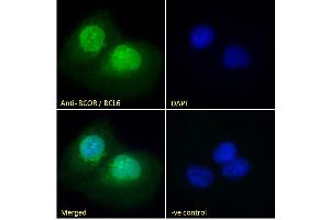 ABIN185043 Immunofluorescence analysis of paraformaldehyde fixed U2OS cells, permeabilized with 0. (BCOR anticorps  (N-Term))