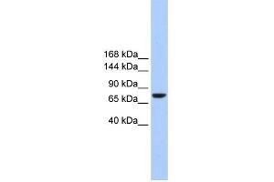 WB Suggested Anti-TMC2 Antibody Titration:  0. (Tmc2 anticorps  (Middle Region))