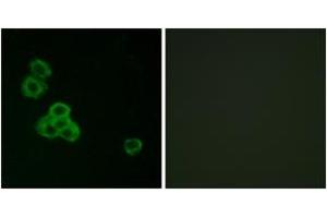 Immunofluorescence analysis of MCF7 cells, using CaMK2 alpha/delta (Ab-286) Antibody. (CaMK2 alpha/delta anticorps  (AA 256-305))