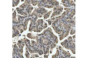 IHC analysis of hnRNP L/HNRNPL using anti-hnRNP L/HNRNPL antibody (ABIN7600130). (HNRNPL anticorps  (AA 152-569))